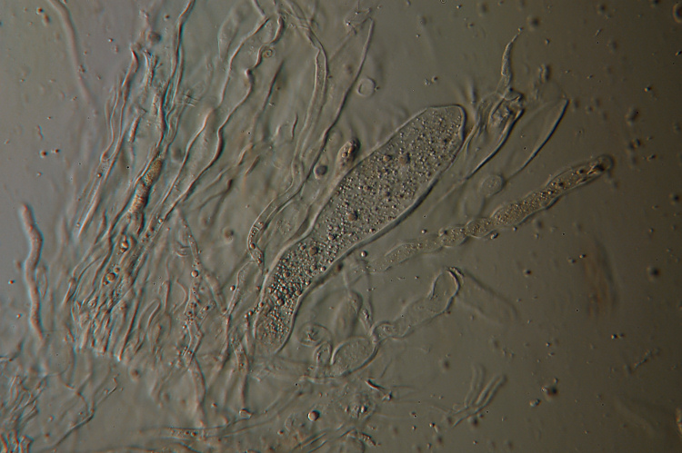 Aleurodiscus amorphus (Fr.)Schroeter